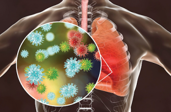 Infecção pulmonar causada por COVID-19 pode deixar sequelas respiratórias